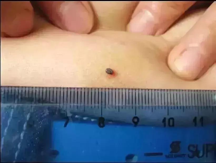 小明快樂疫情日志，最新疫情發(fā)布與日常觀察